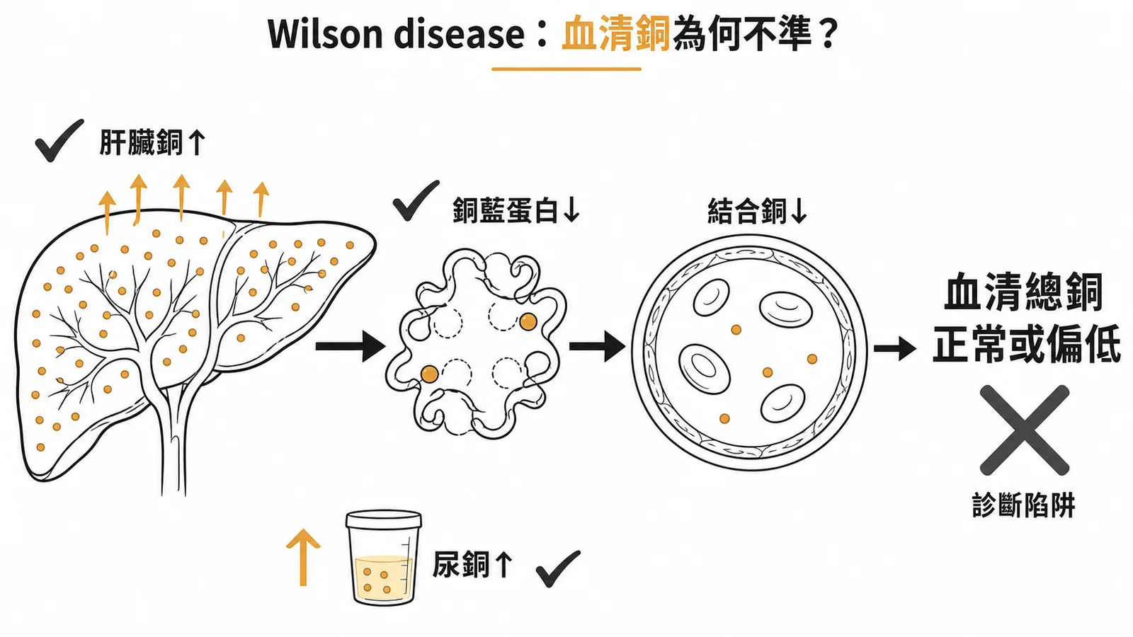 Wilson disease銅代謝陷阱——肝臟銅與尿銅升高但血清總銅因銅藍蛋白下降而偏低