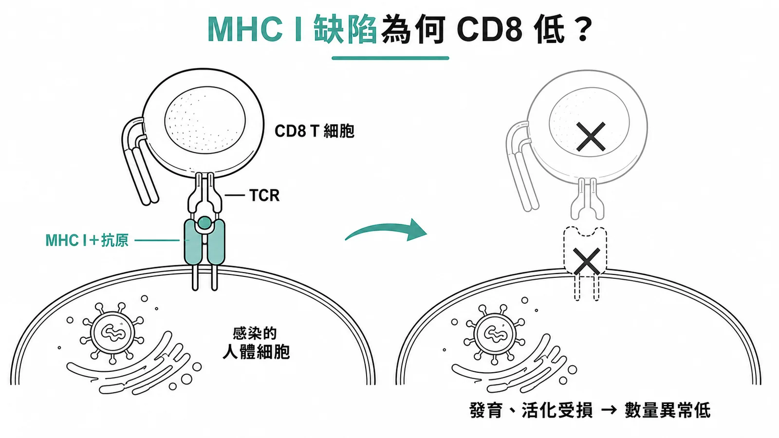 MHC class I 缺陷導致 CD8 T 細胞無法正常辨識抗原、發育活化受損而數量異常低