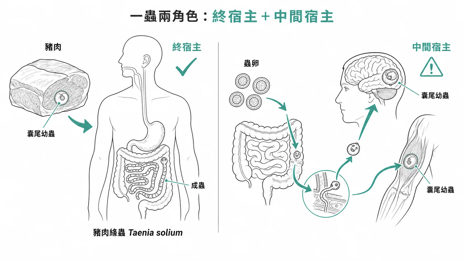 豬肉絛蟲讓人同時扮演終宿主(吃豬肉→成蟲)與中間宿主(誤食蟲卵→囊尾幼蟲症)