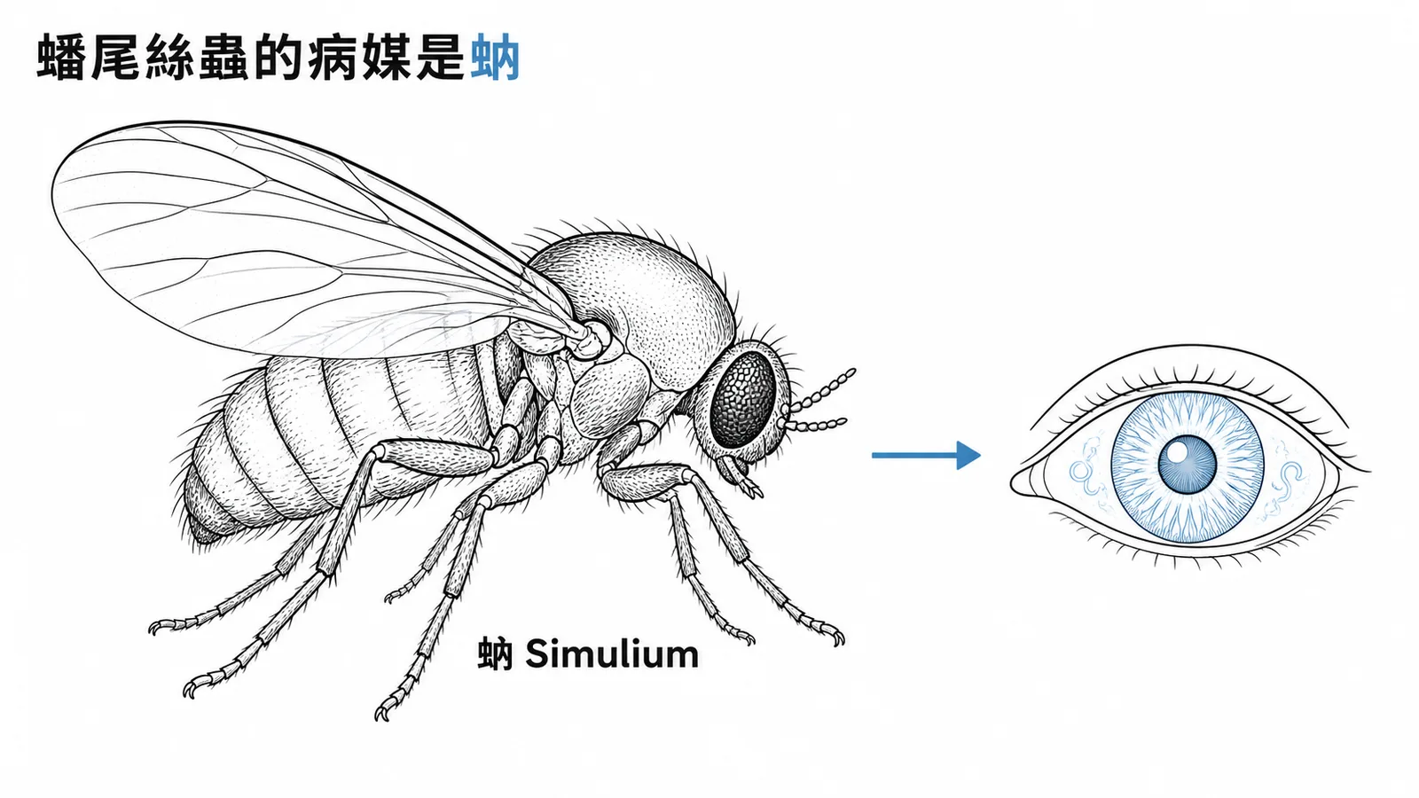 蟠尾絲蟲的病媒是蚋(Simulium),可引起河盲症