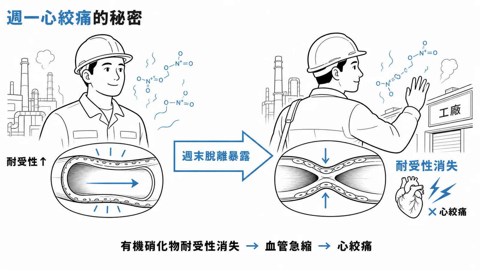 週一心絞痛:有機硝化物耐受性消失導致血管急縮