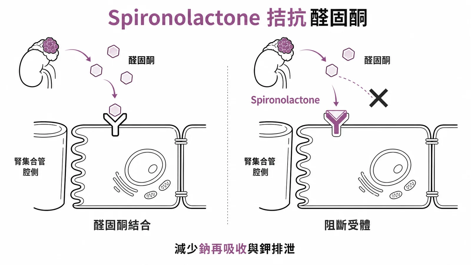 Spironolactone 阻斷腎小管醛固酮受體，改善高血壓與低血鉀