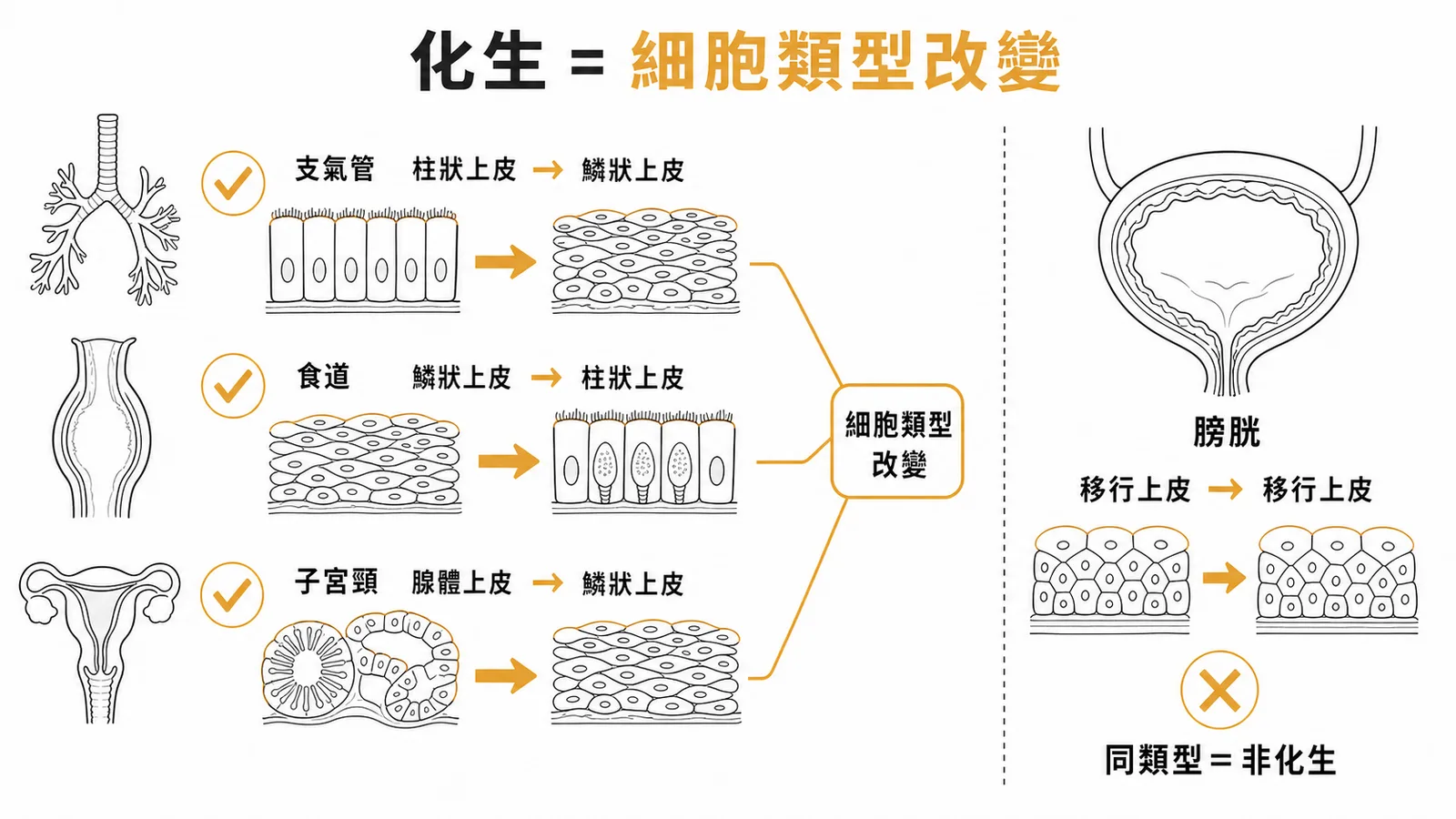 化生是細胞類型改變，膀胱移行上皮取代移行上皮非化生