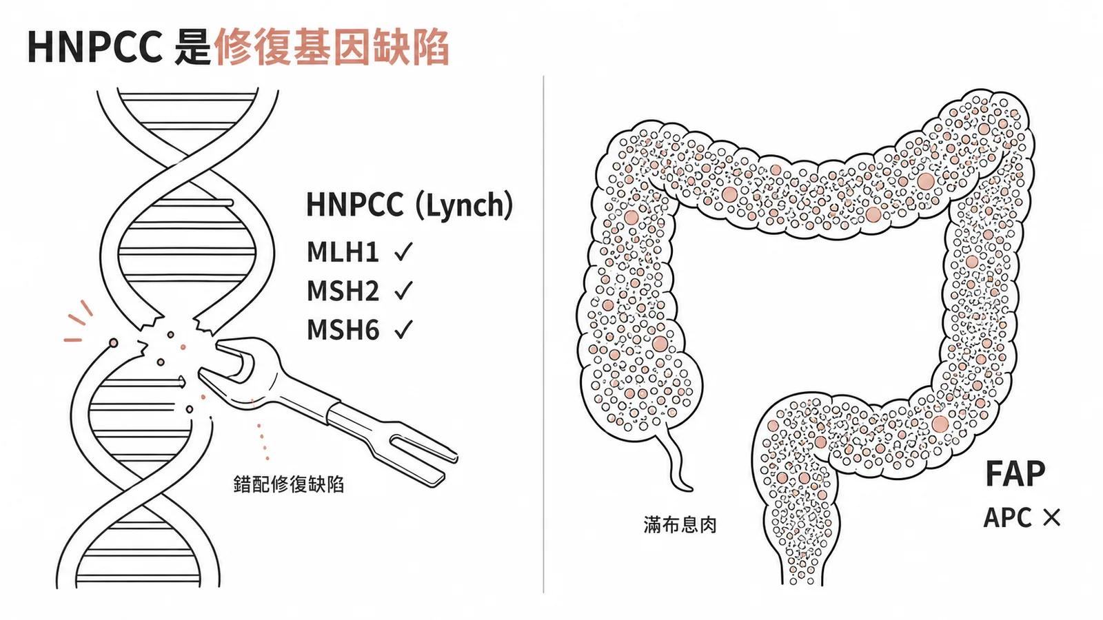 HNPCC 是 DNA 錯配修復基因缺陷，APC 突變屬 FAP 非 HNPCC