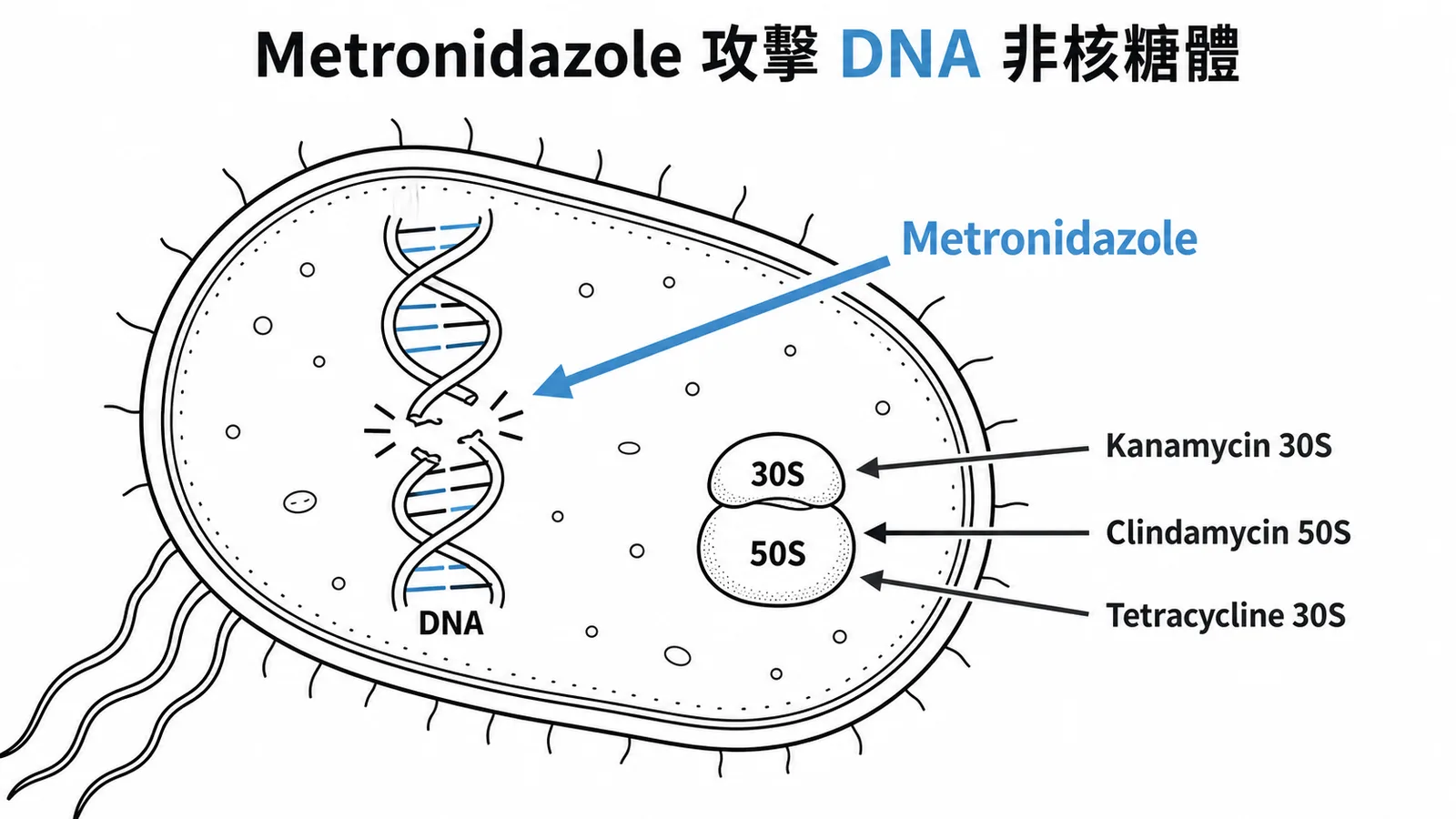 Metronidazole破壞DNA而非抑制核糖體蛋白質合成