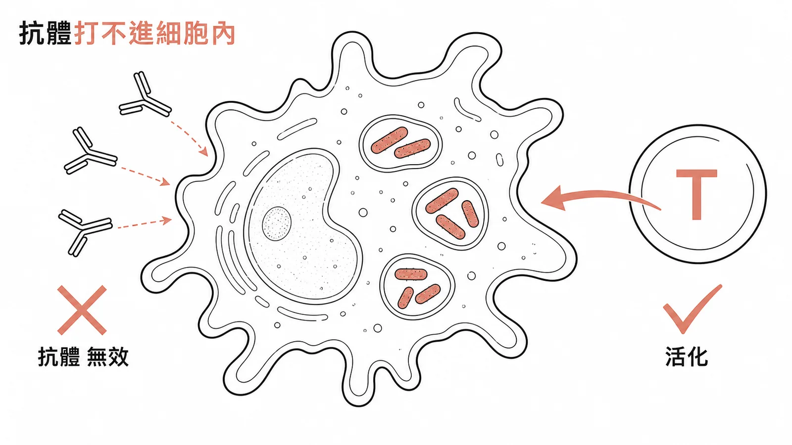 退伍軍人桿菌躲在巨噬細胞內,抗體無法進入,必須靠T細胞活化細胞免疫才能殺滅