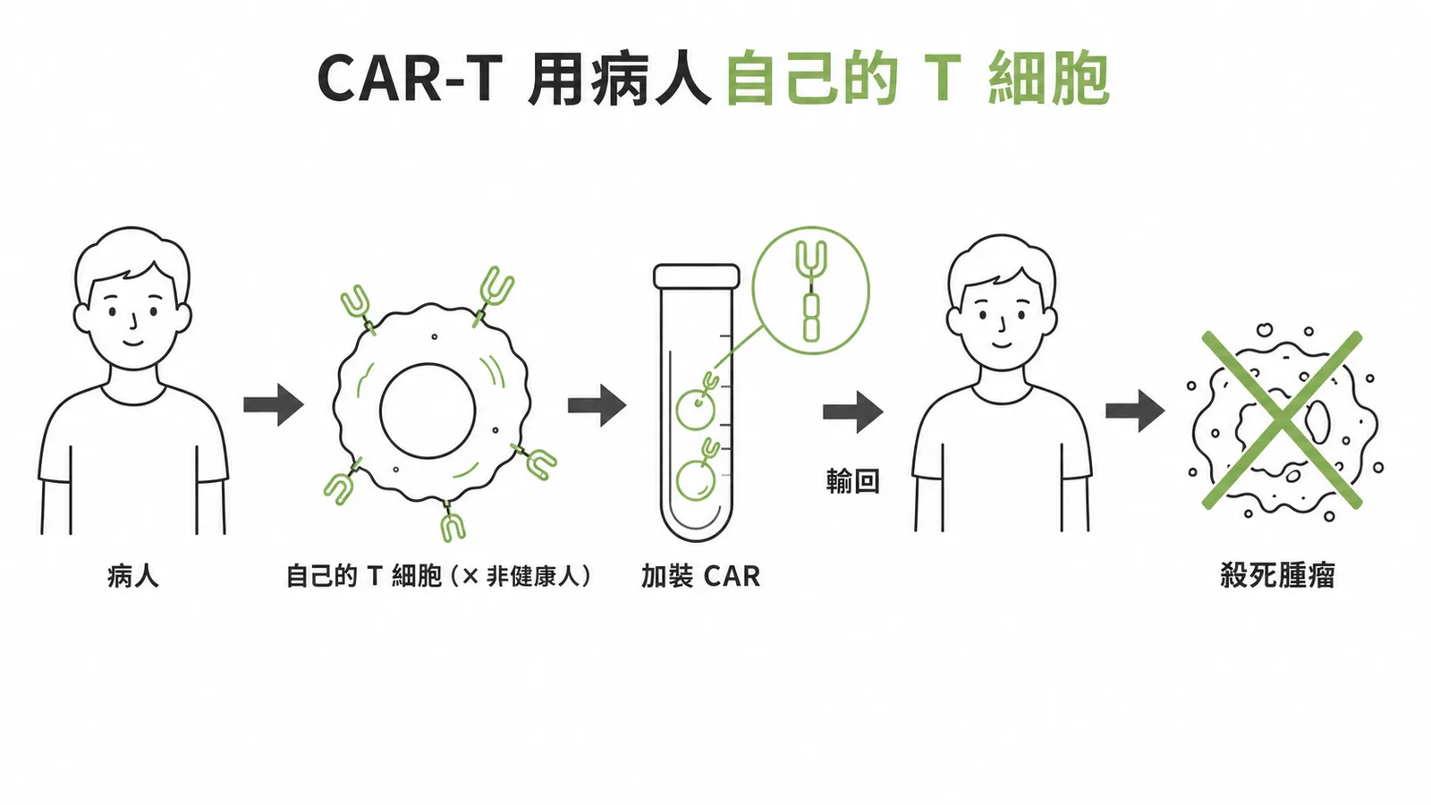 CAR-T療法取病人自己的T細胞改造後輸回攻擊腫瘤