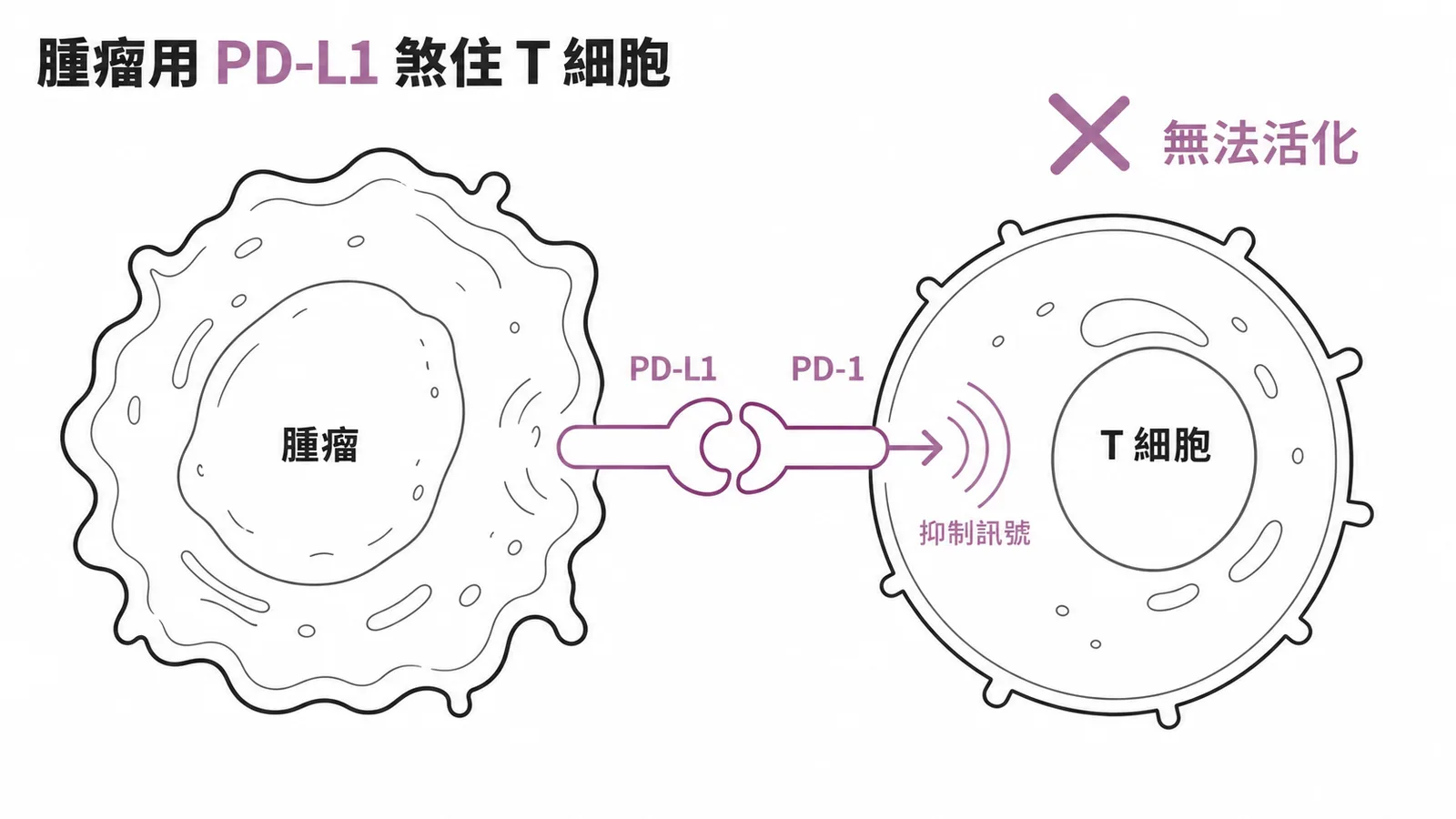 腫瘤細胞表達PD-L1結合T細胞PD-1發出抑制訊號