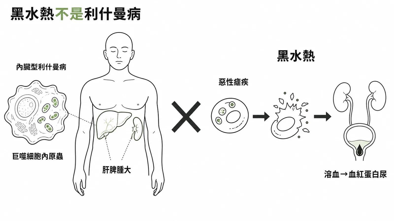 黑水熱屬惡性瘧疾併發症，與內臟型利什曼病無關