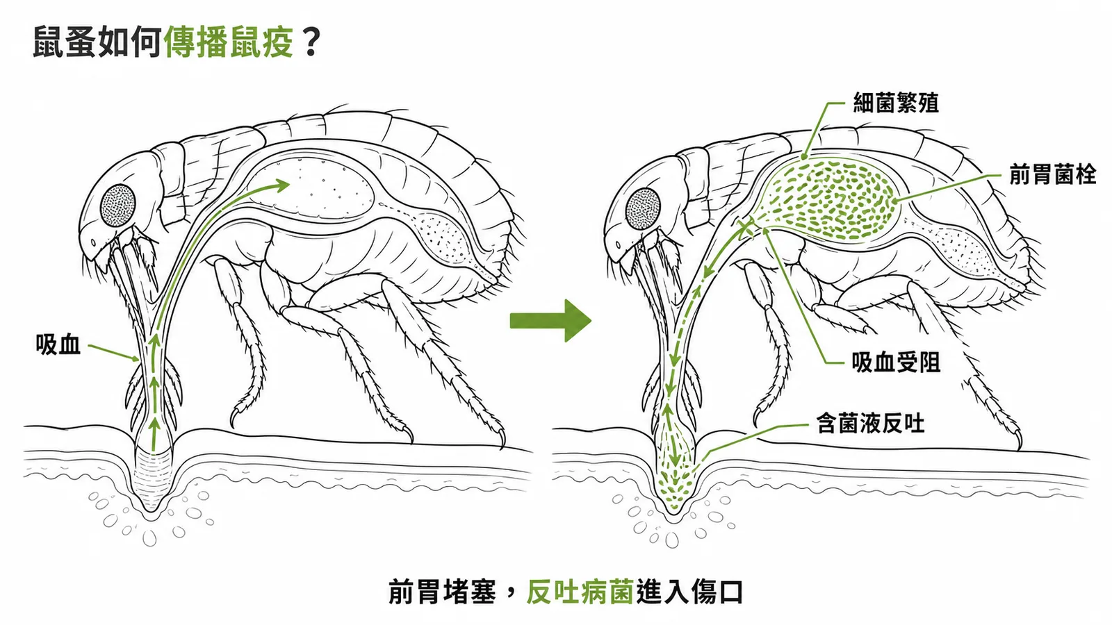 鼠蚤前胃菌栓堵塞後反吐含菌液傳播鼠疫