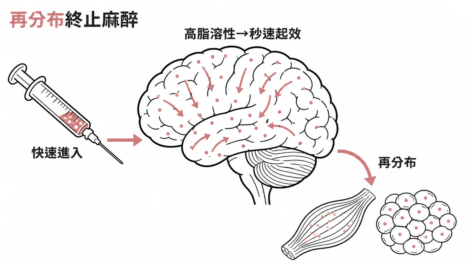 Thiopental 再分布機轉:高脂溶性快速入腦後再分布至肌肉脂肪終止麻醉