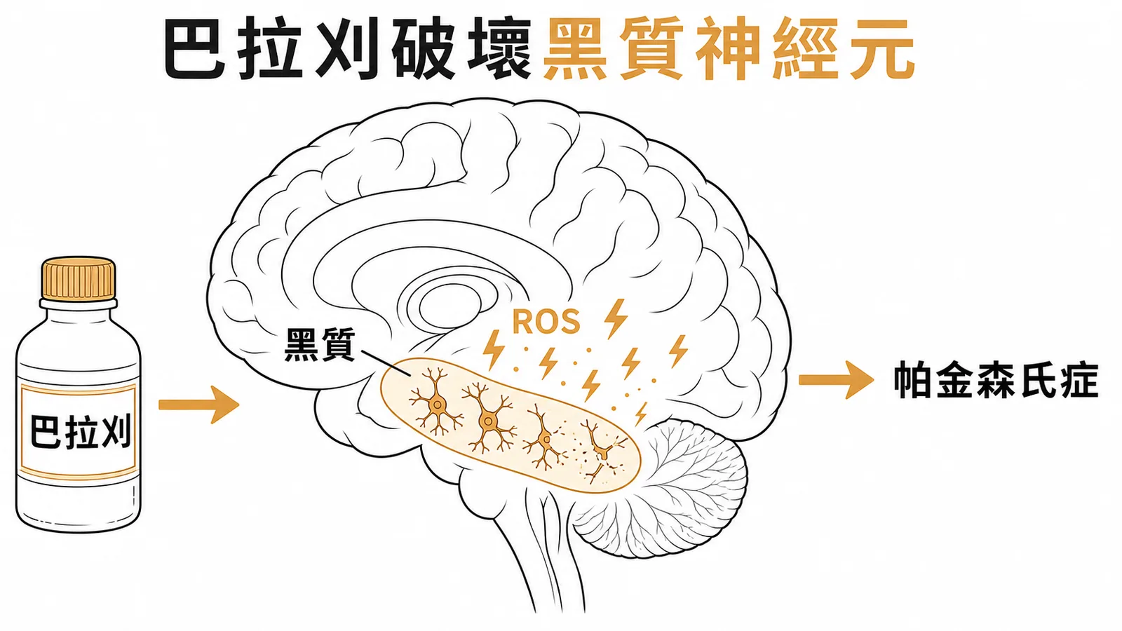 巴拉刈產生 ROS 破壞黑質多巴胺神經元導致帕金森氏症