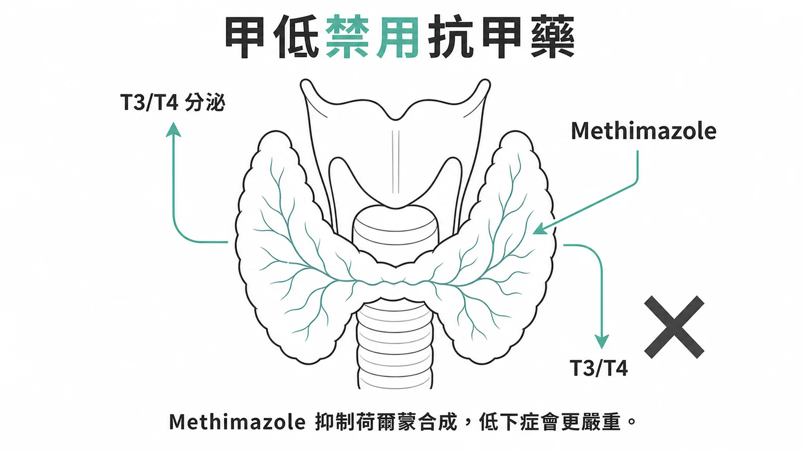 甲狀腺機能低下禁用 Methimazole:抑制荷爾蒙合成會加重病情