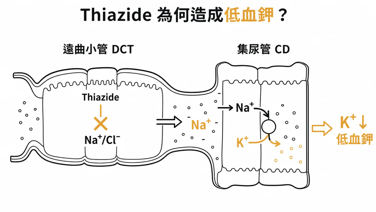 Thiazide 阻斷遠曲小管 Na⁺/Cl⁻ 再吸收，集尿管 Na⁺/K⁺ 交換增加導致低血鉀