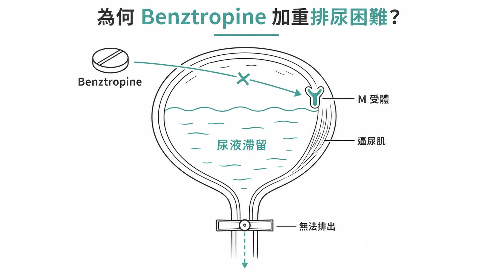 Benztropine阻斷膀胱M受體導致尿液滯留示意圖