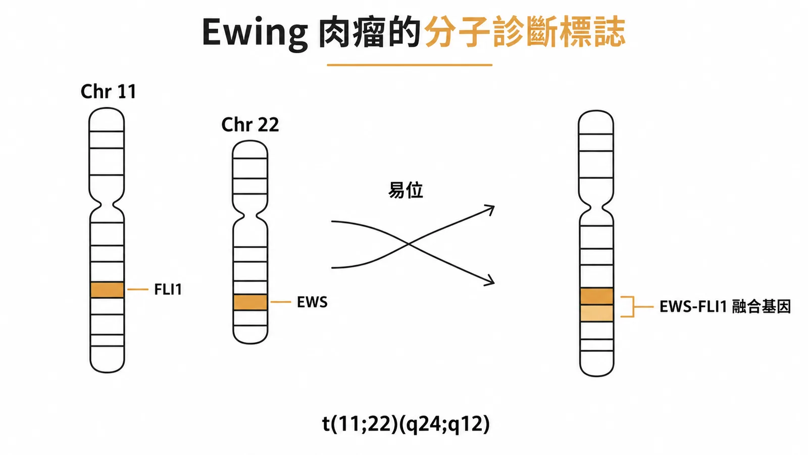 Ewing肉瘤t(11;22)染色體易位產生EWS-FLI1融合基因示意圖