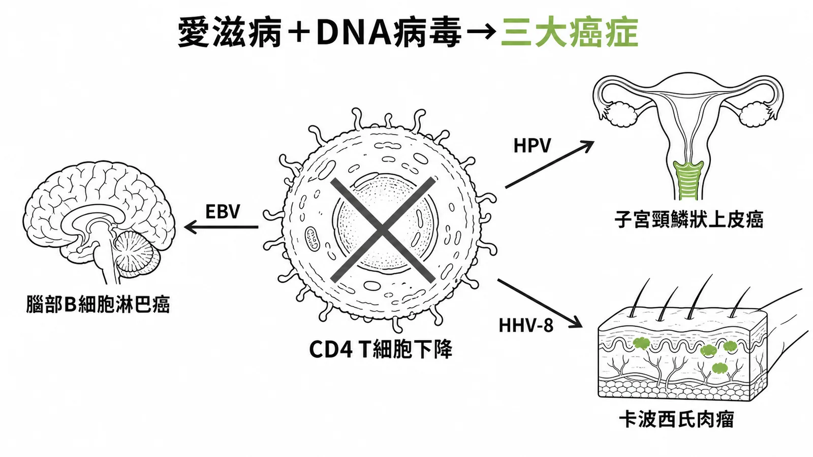 愛滋病免疫低下與三種DNA病毒相關癌症的對應關係