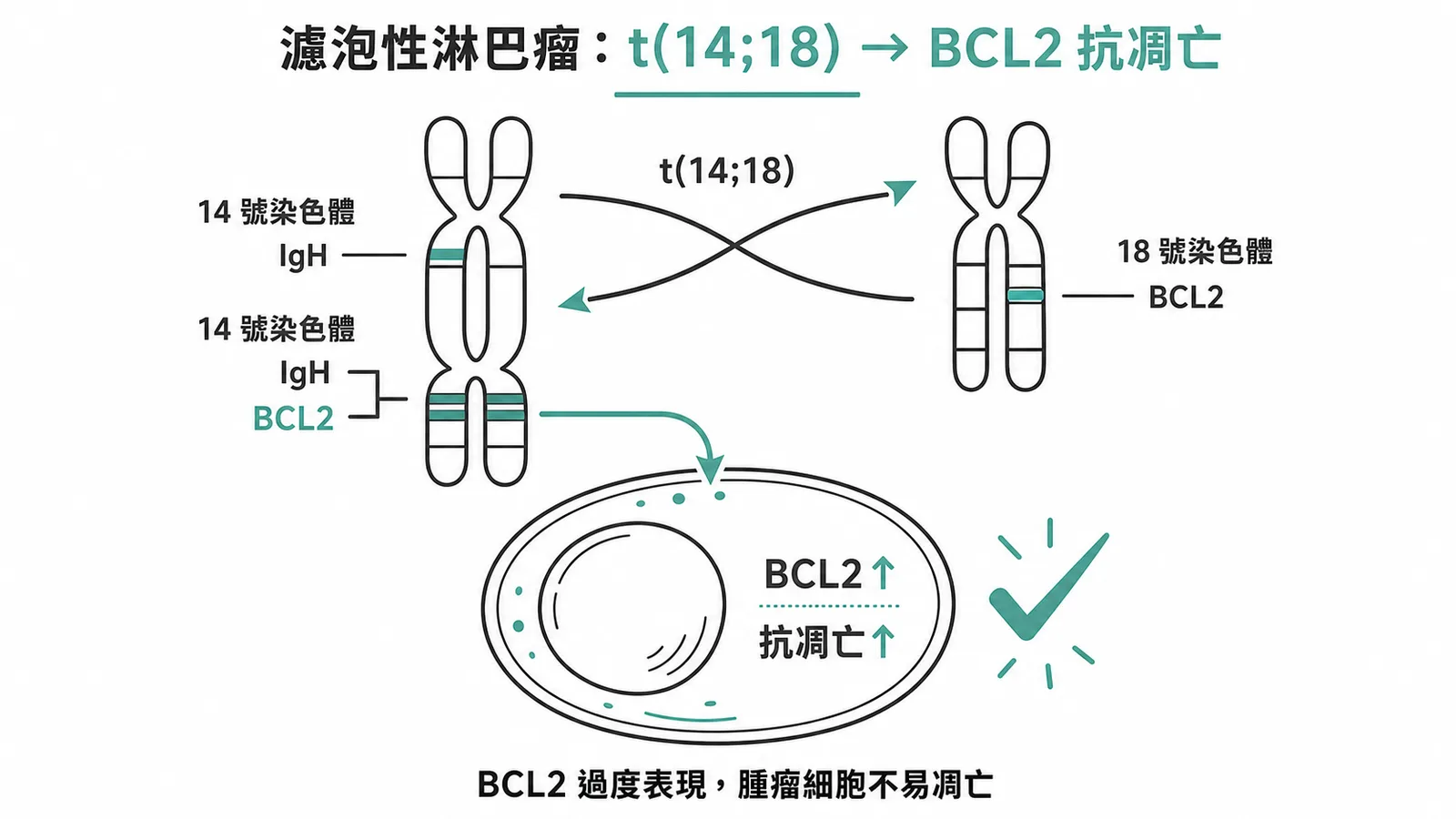 濾泡性淋巴瘤t(14;18)轉位導致BCL2過度表現與抗凋亡