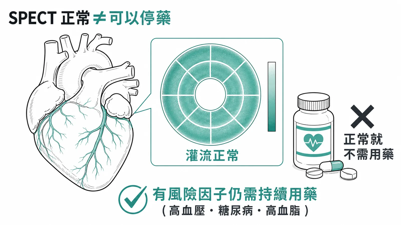 SPECT 正常不等於可以停藥:有風險因子(高血壓、糖尿病、高血脂)仍需持續用藥