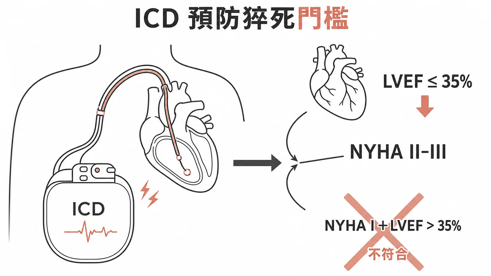 ICD一級預防猝死的適應門檻示意