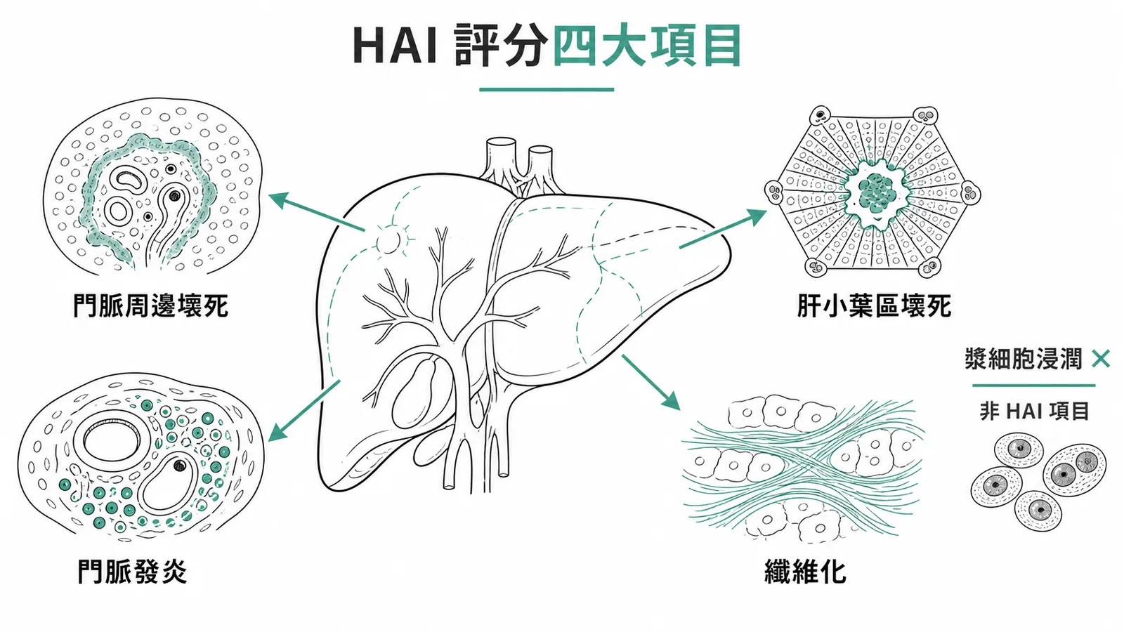 HAI評分系統四大項目與漿細胞浸潤排除