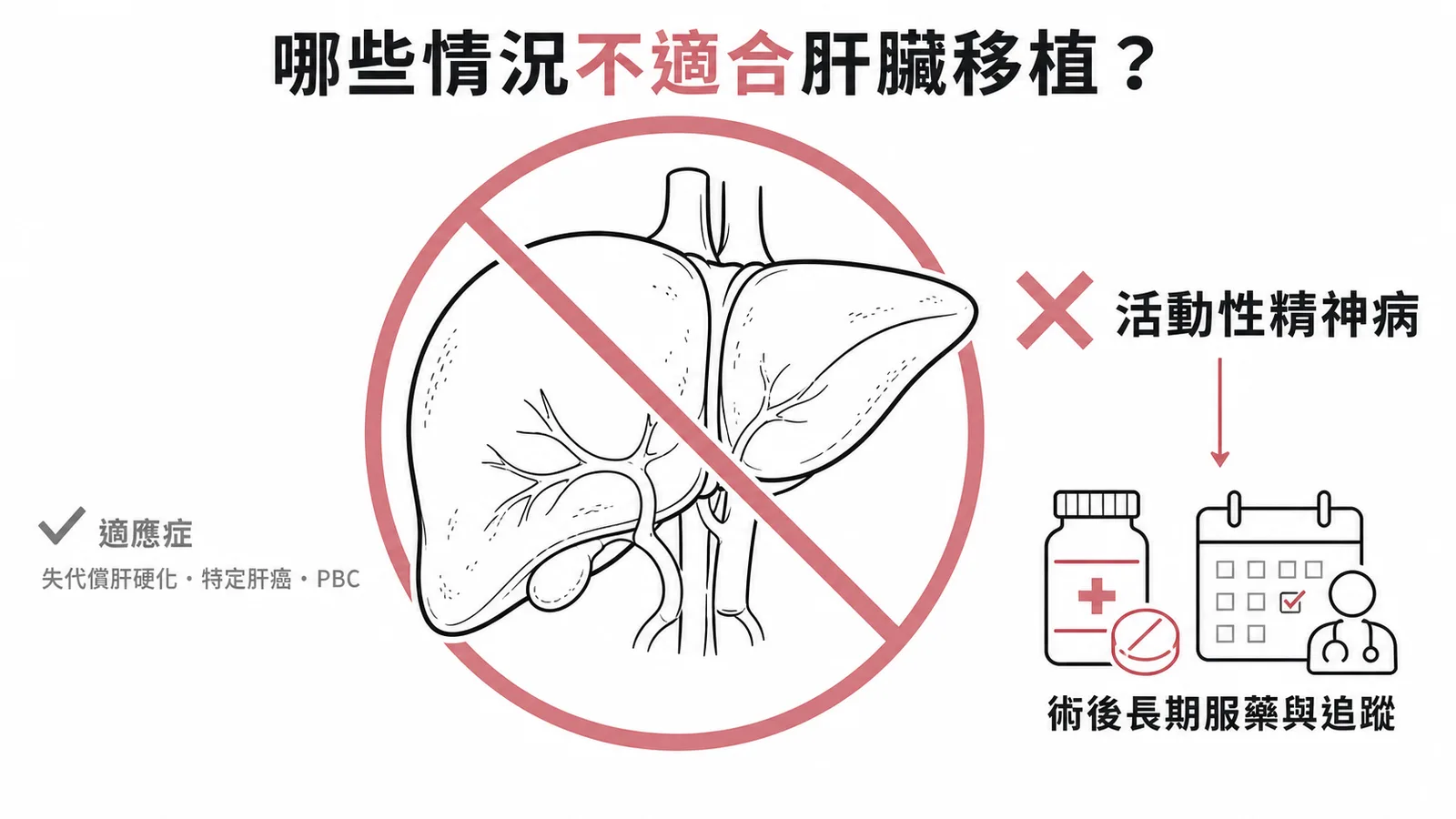 肝臟移植禁忌症示意圖:活動性精神病因影響術後藥物依從性而為禁忌,適應症包括失代償肝硬化、特定肝癌、PBC