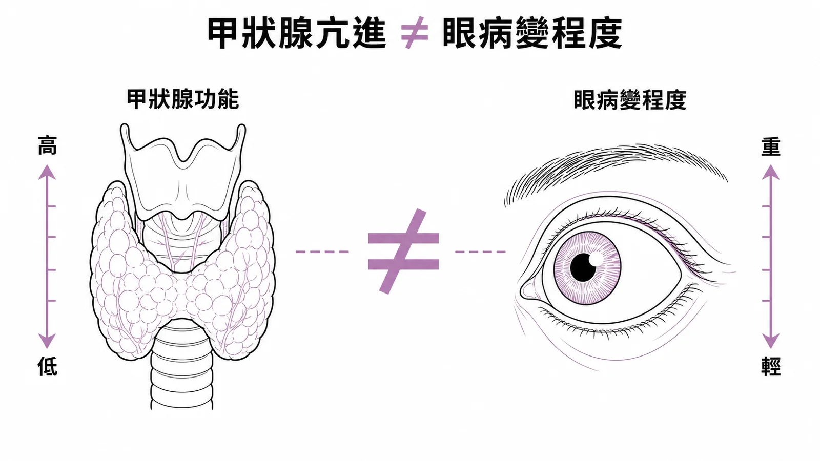 葛瑞夫氏病:甲狀腺功能亢進程度與眼病變嚴重度不成正相關,兩者可獨立發展