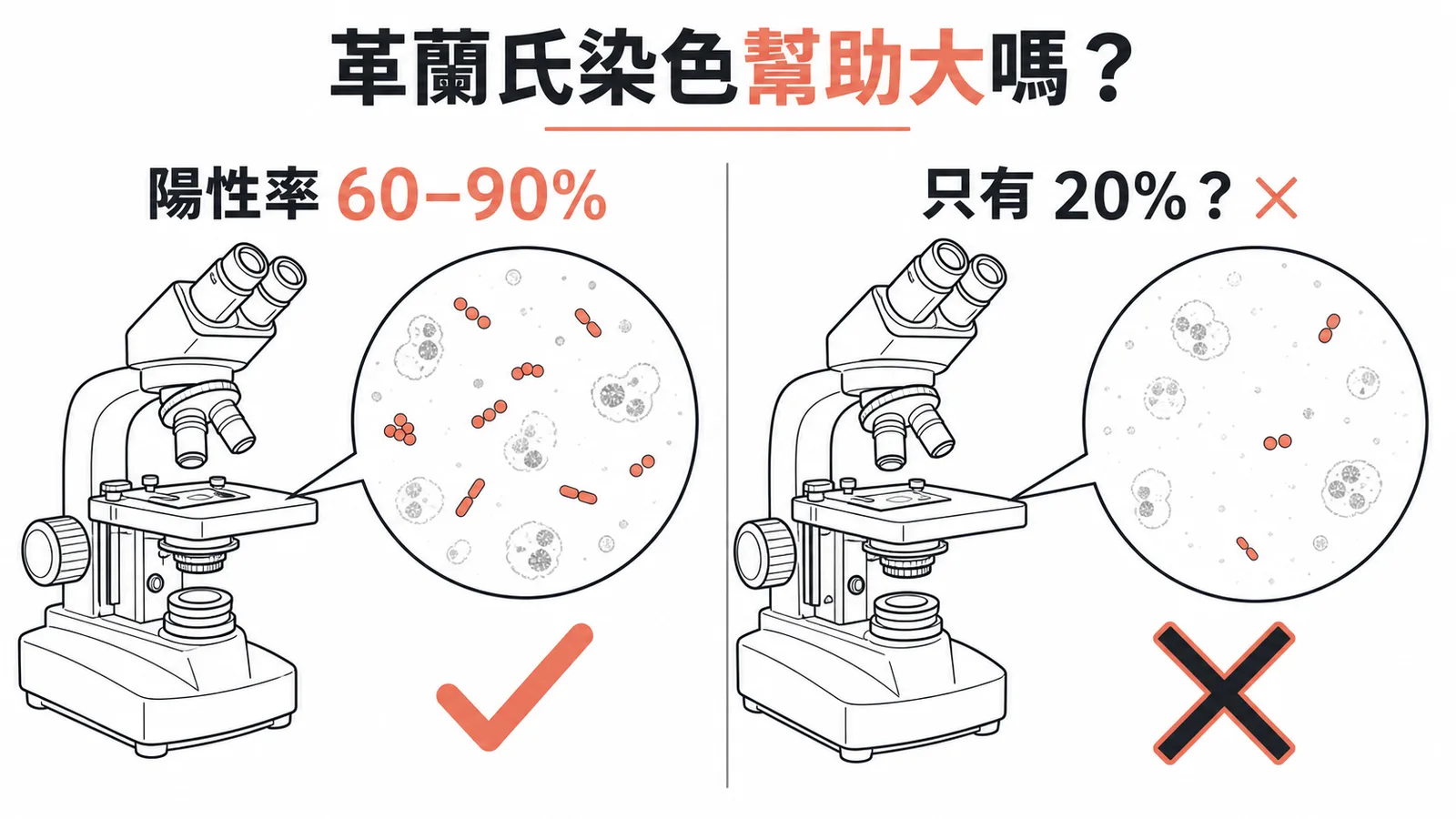 細菌性腦膜炎CSF革蘭氏染色陽性率60-90%與錯誤認知20%的對照示意圖