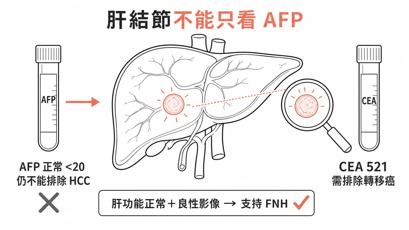 肝結節鑑別:AFP 正常排除 HCC,CEA 升高需排除轉移,支持 FNH