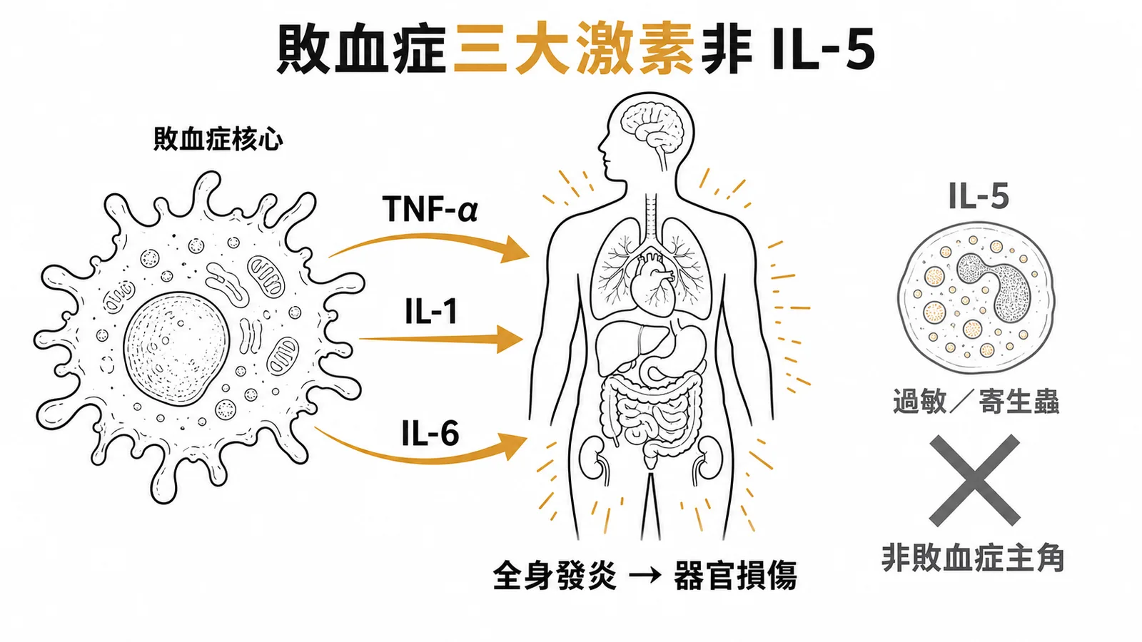 敗血症核心促炎激素TNF-α、IL-1、IL-6,IL-5與敗血症無關