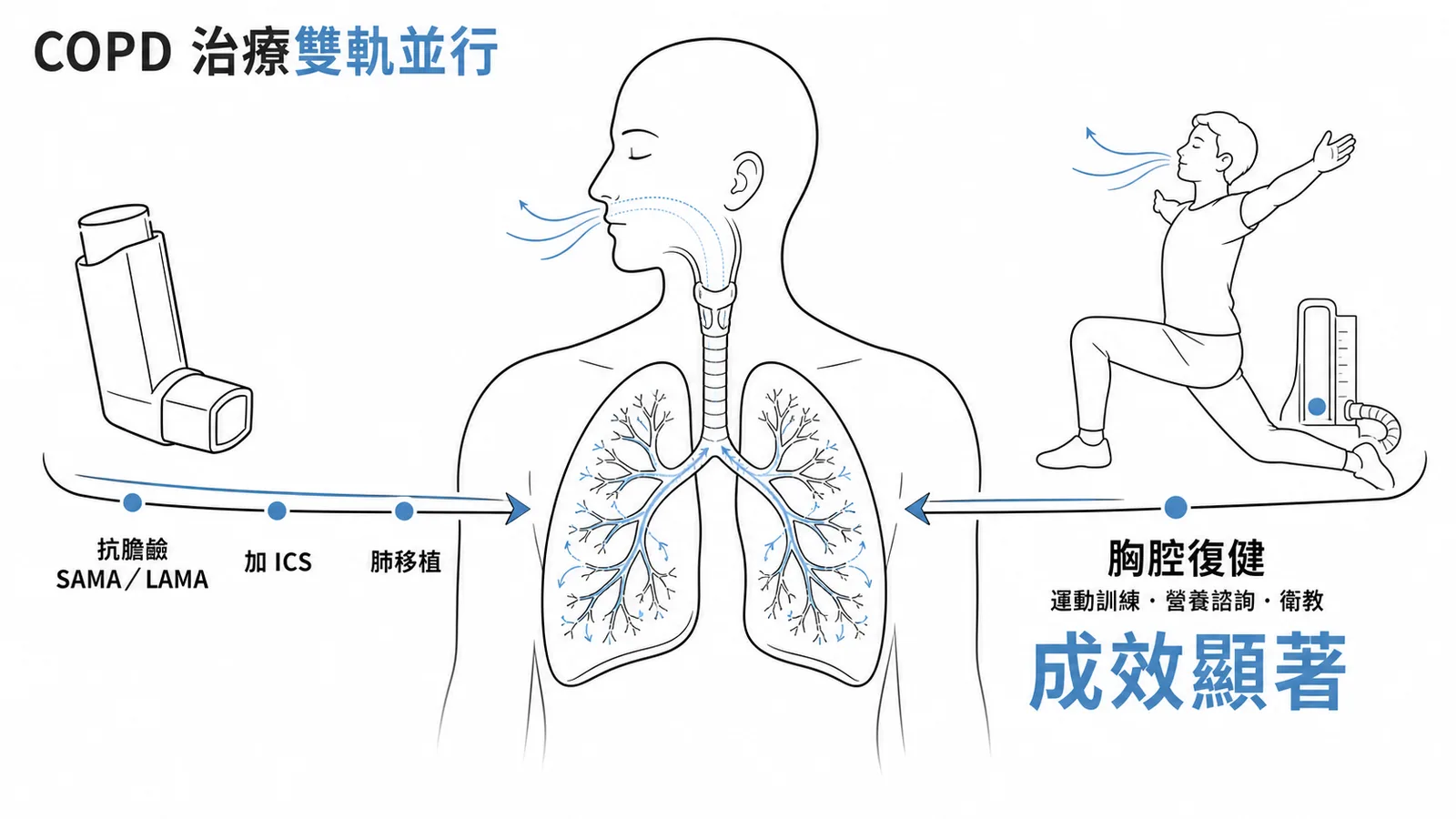 COPD治療雙軌並行——藥物階梯與胸腔復健成效顯著