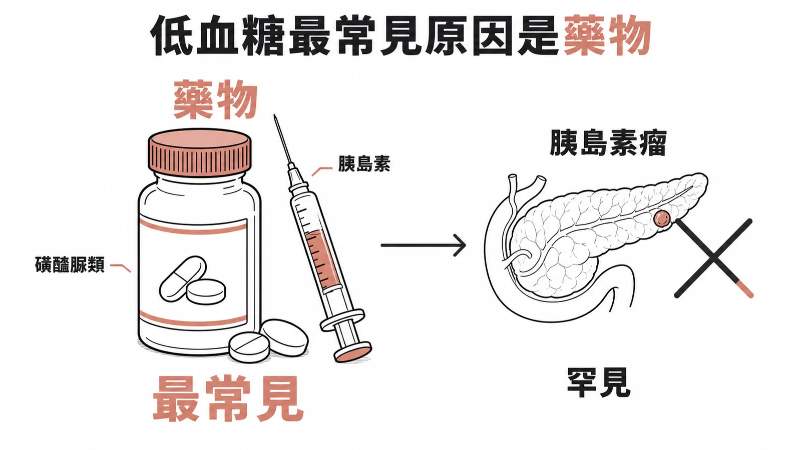 低血糖最常見原因是藥物而非胰島素瘤