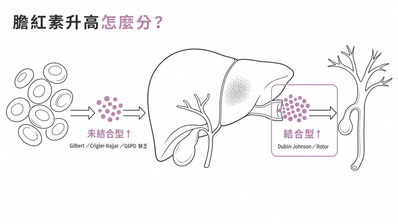 膽紅素升高鑑別：未結合型與結合型升高的病因對照