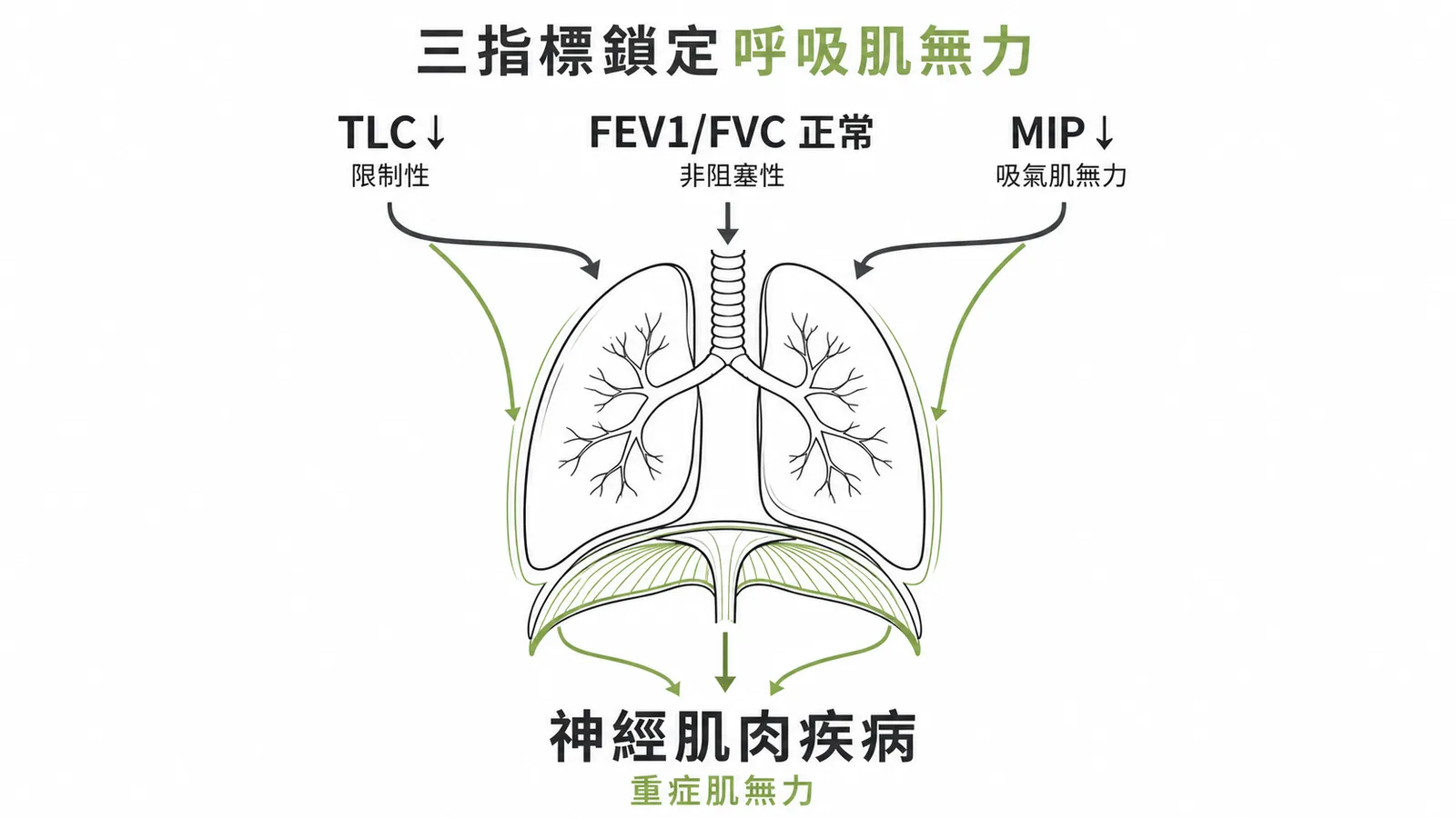 肺功能三指標TLC降FEV1FVC正常MIP降鎖定神經肌肉疾病示意圖