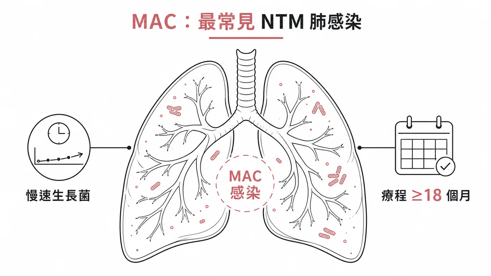 MAC是最常見NTM肺感染菌需長程治療