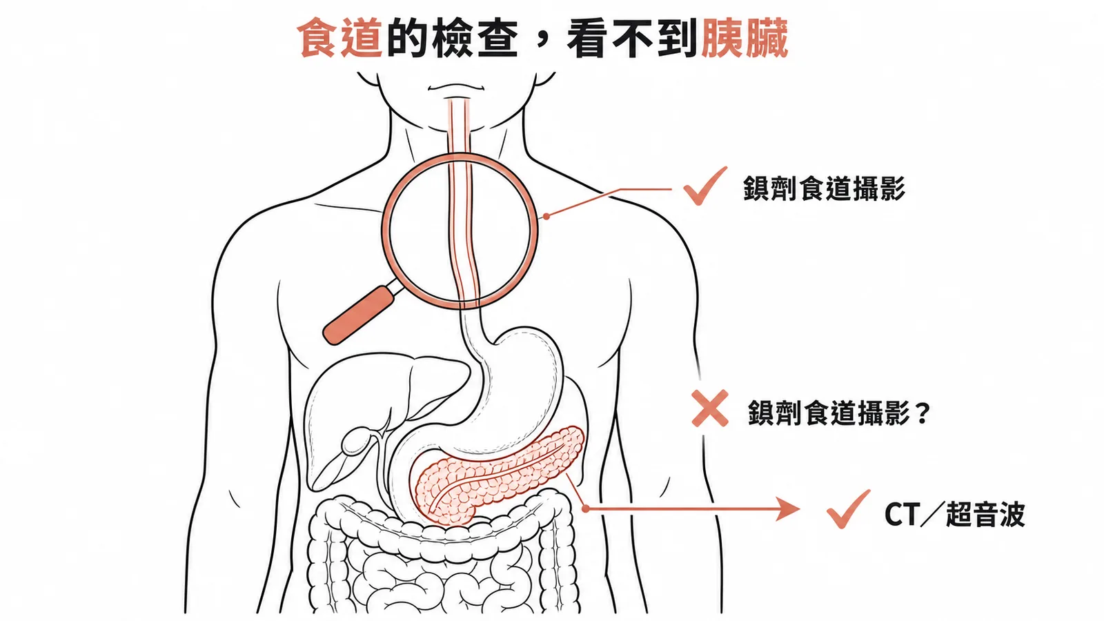 鋇劑食道攝影只能檢查食道而非胰臟——胰臟應用CT或超音波