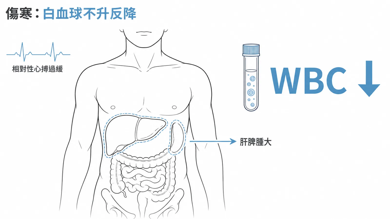 傷寒特徵——白血球不升反降合併肝脾腫大與相對性心搏過緩