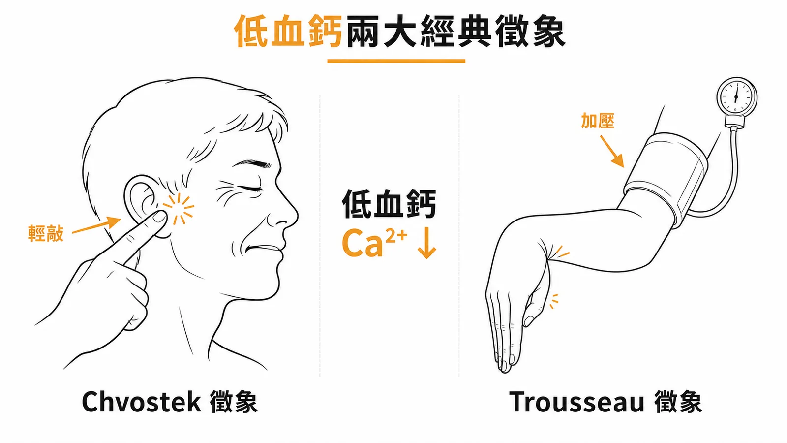 低血鈣兩大經典徵象Chvostek敲面神經與Trousseau血壓計加壓引起手腕痙攣