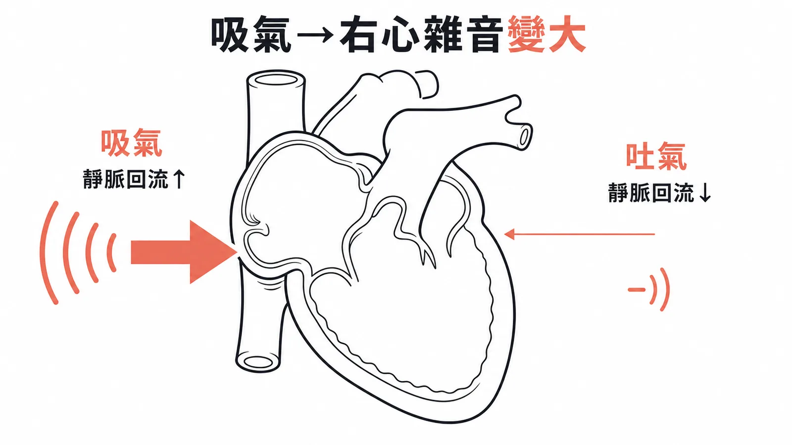 吸氣增加右心回流使右心雜音變大