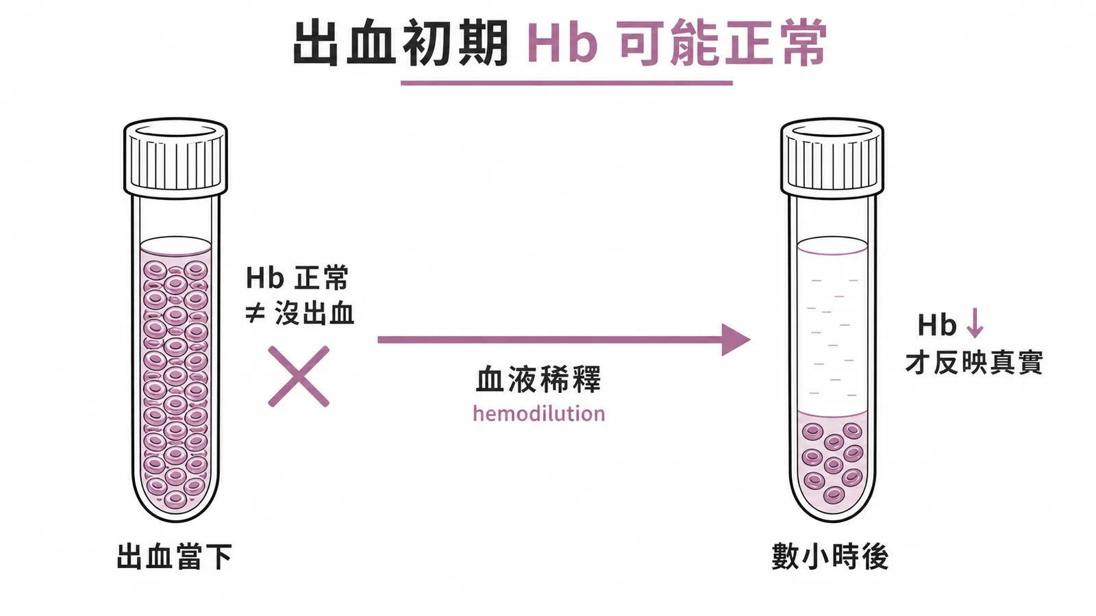 急性出血初期血色素可能正常需等數小時血液稀釋後才下降