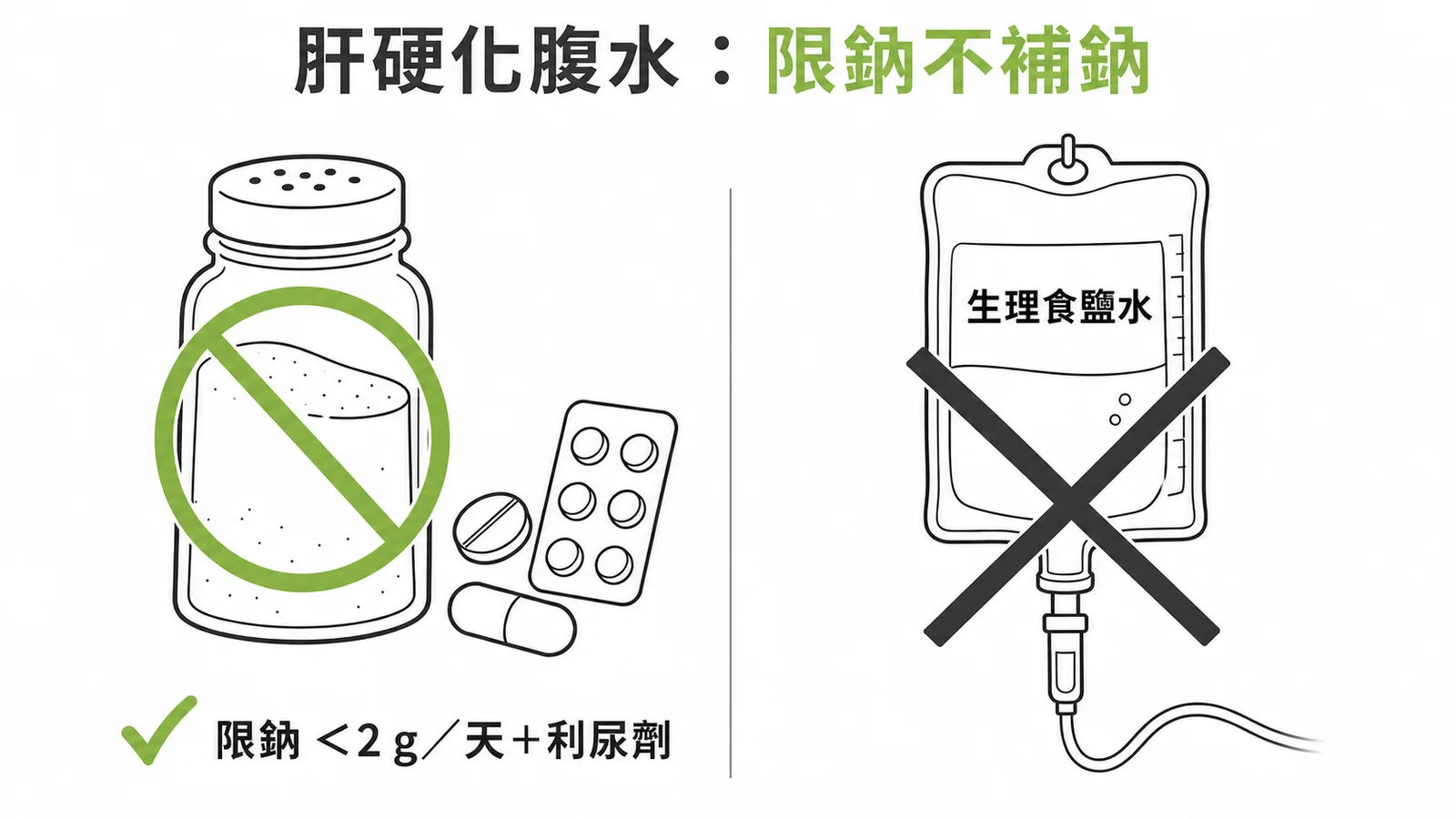 肝硬化腹水治療原則:限鈉加利尿劑,禁止補鈉或輸注生理食鹽水