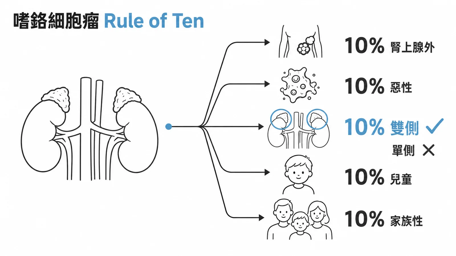嗜鉻細胞瘤 Rule of Ten:10% 腎上腺外、惡性、雙側、兒童、家族性