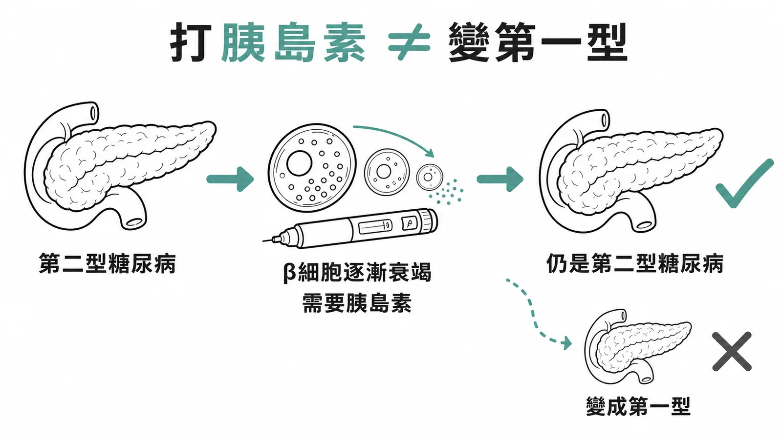 第二型糖尿病打胰島素不等於轉變為第一型