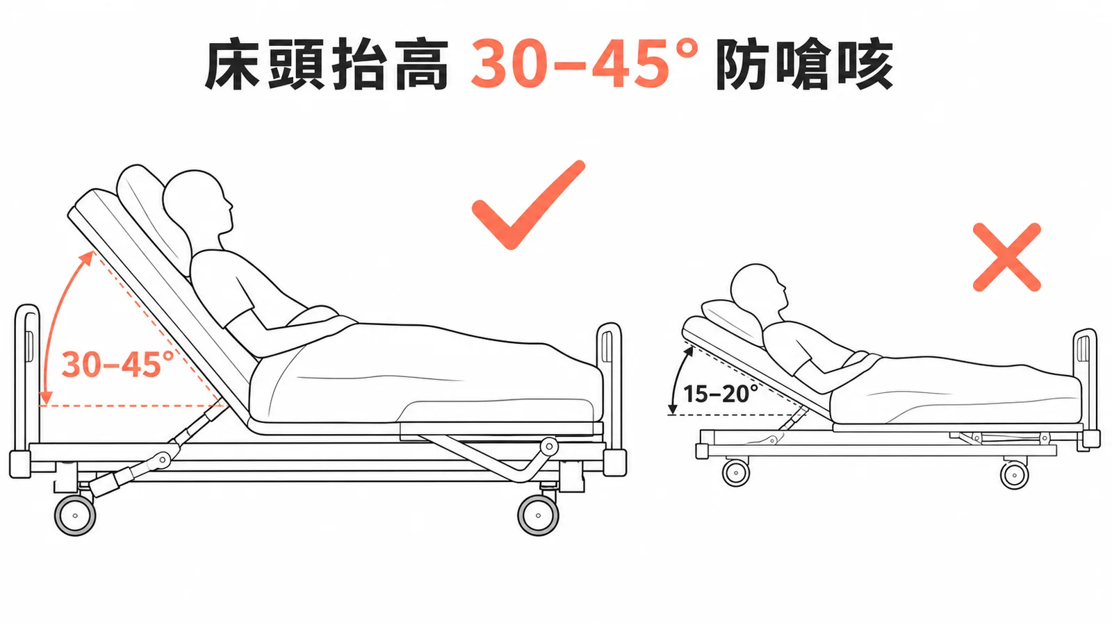 預防 HCAP 床頭抬高建議 30-45 度,非 15-20 度