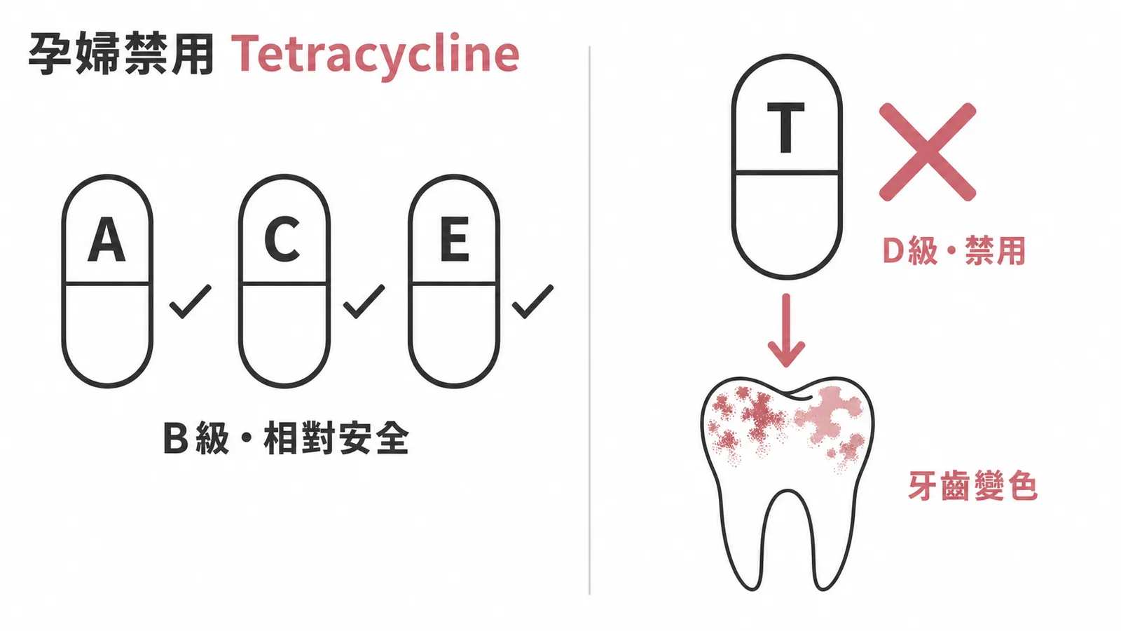 孕婦禁用 Tetracycline(D 級),致胎兒牙齒變色
