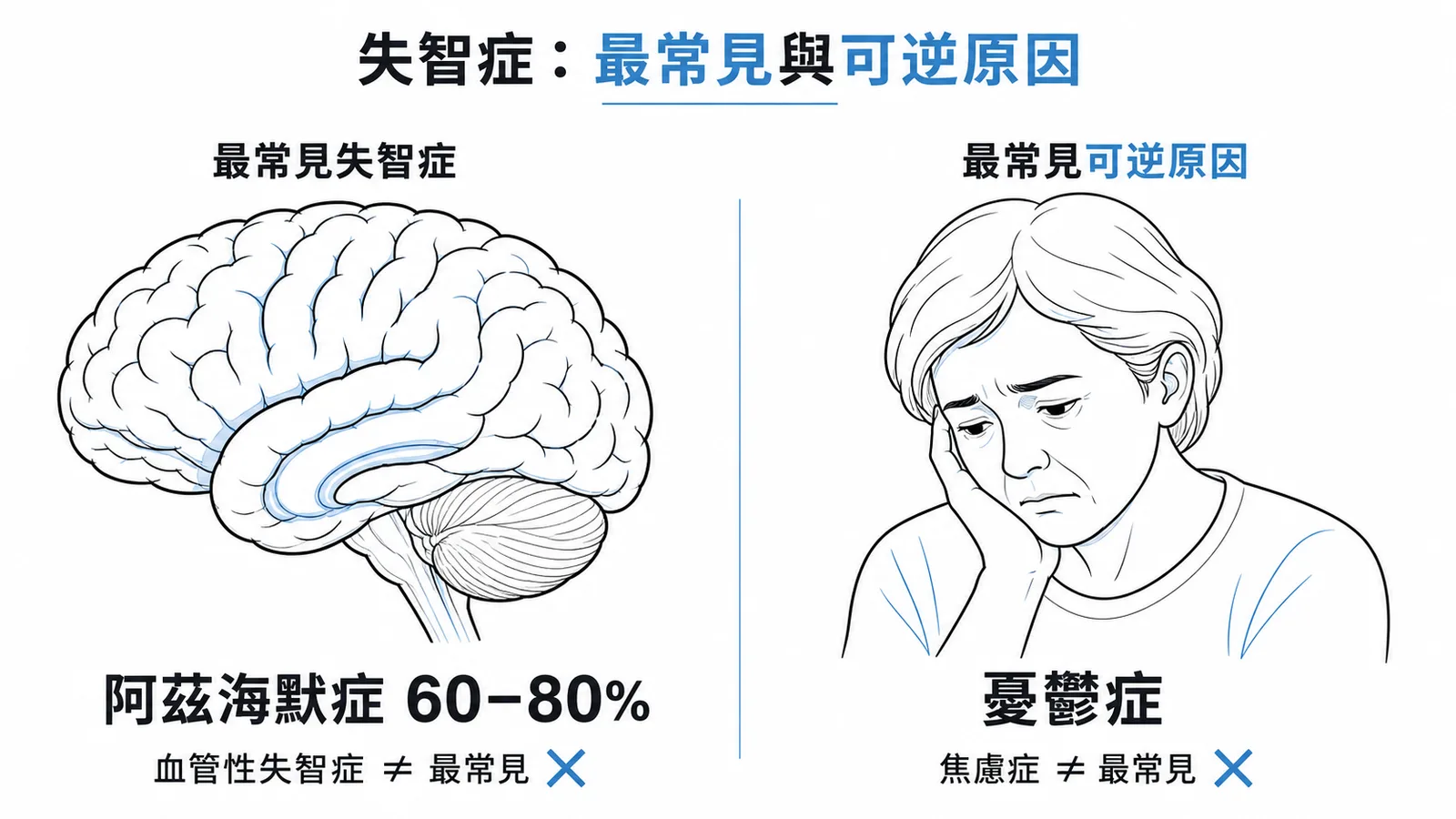 失智症最常見類型為阿茲海默症,最常見可逆原因為憂鬱症