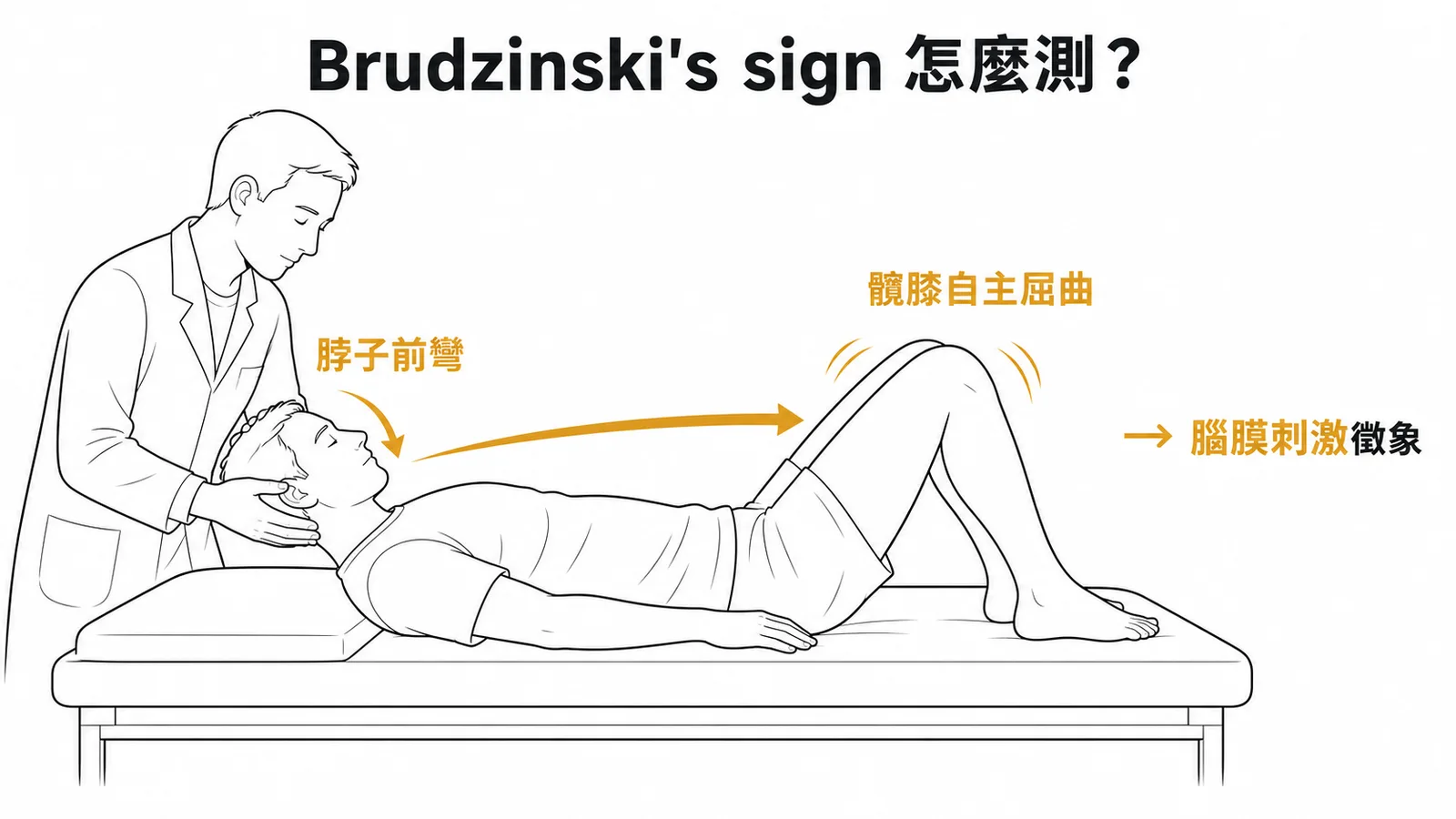 Brudzinski's sign:脖子前彎引發髖膝自主屈曲,為腦膜刺激徵象