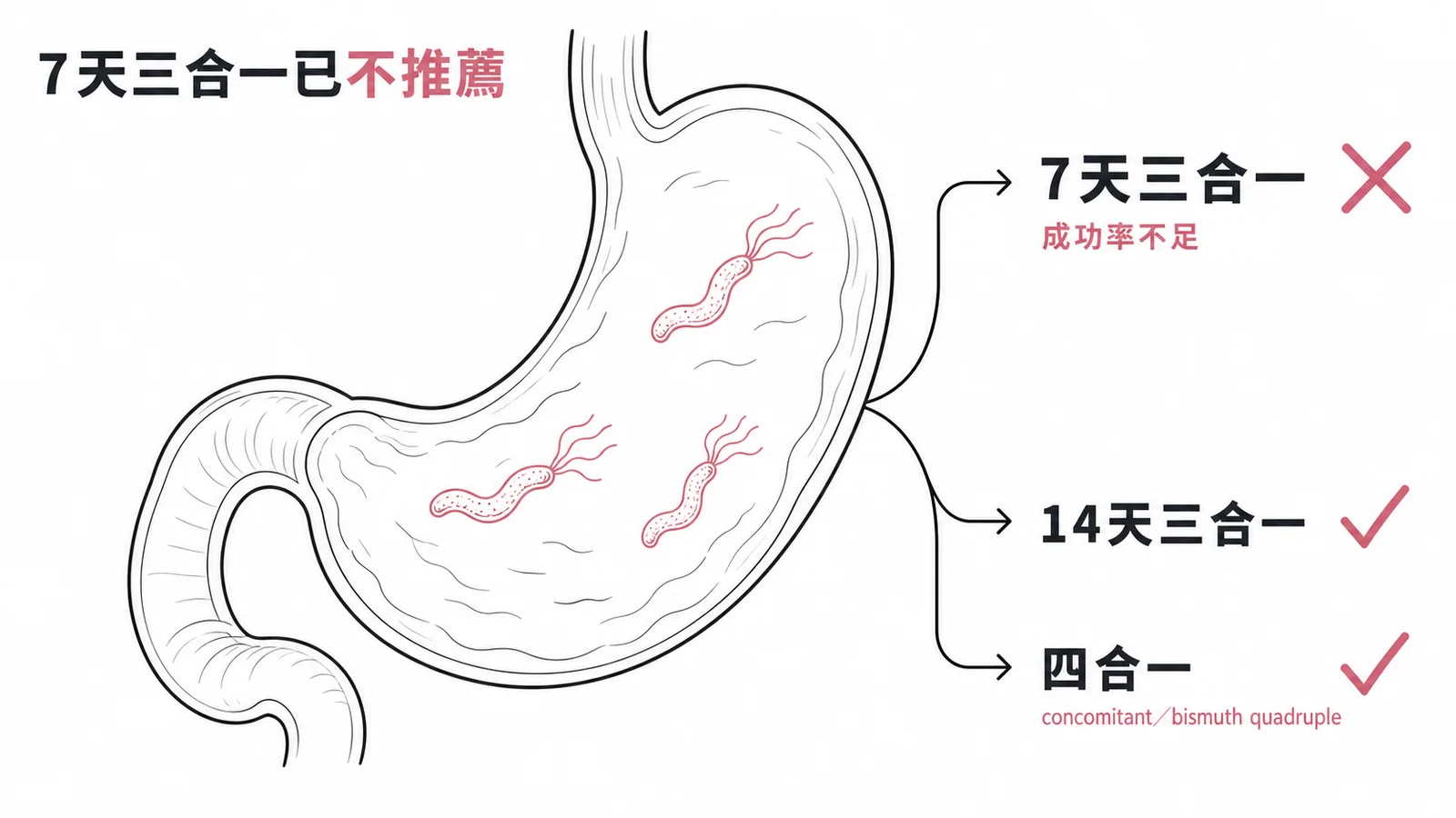 幽門螺旋桿菌除菌方案:7天三合一已不推薦