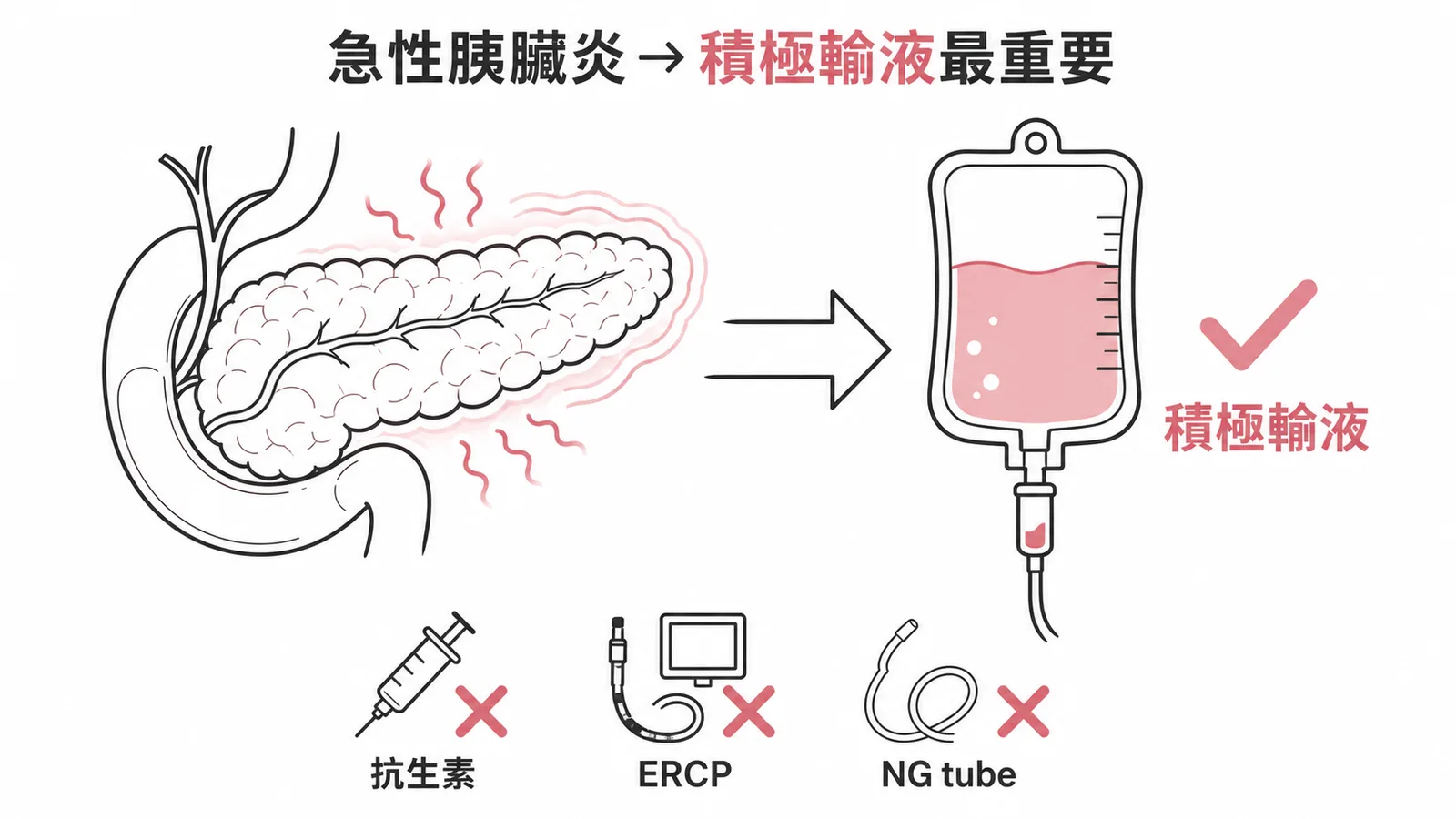 急性胰臟炎初期最重要治療為積極輸液