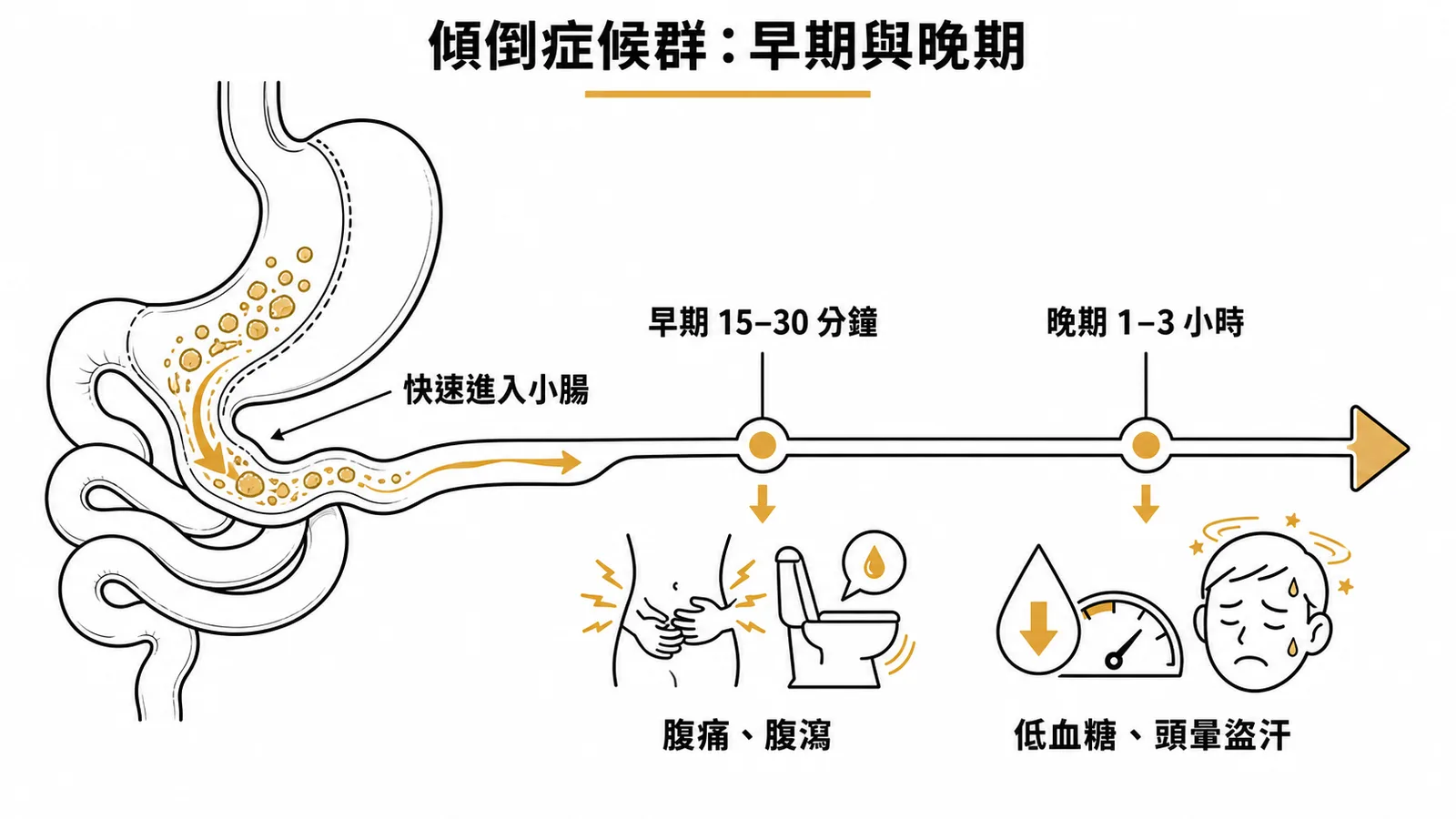 傾倒症候群早期與晚期時間軸:15-30分鐘腹痛腹瀉,1-3小時低血糖頭暈盜汗